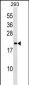 PPIL3 Antibody (C-term)